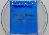 Forensic DNA Fingerprinting